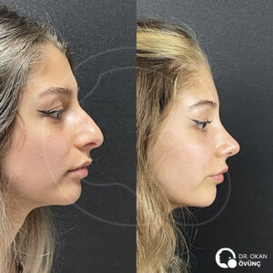 03-3